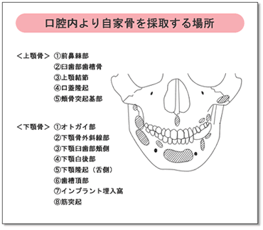 o莩ƍ̎悷ꏊ