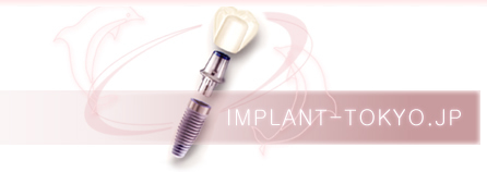 IMPLANT-TOKYO.JP